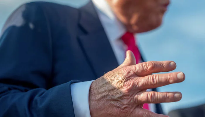 White House Addresses President Trump’s Health: Leg Swelling and Hand Bruising Deemed Benign